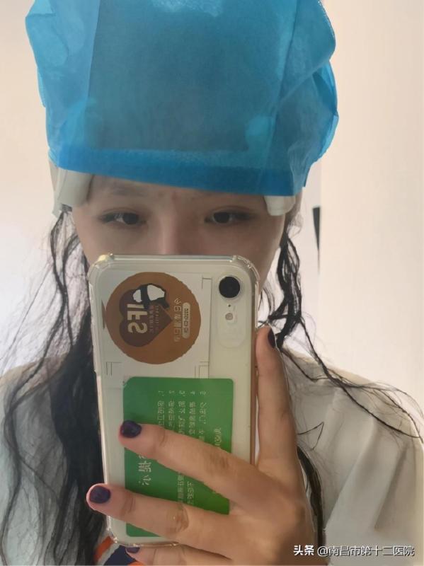 小姐姐分享自己的植發經歷，不得不說真的加分不少